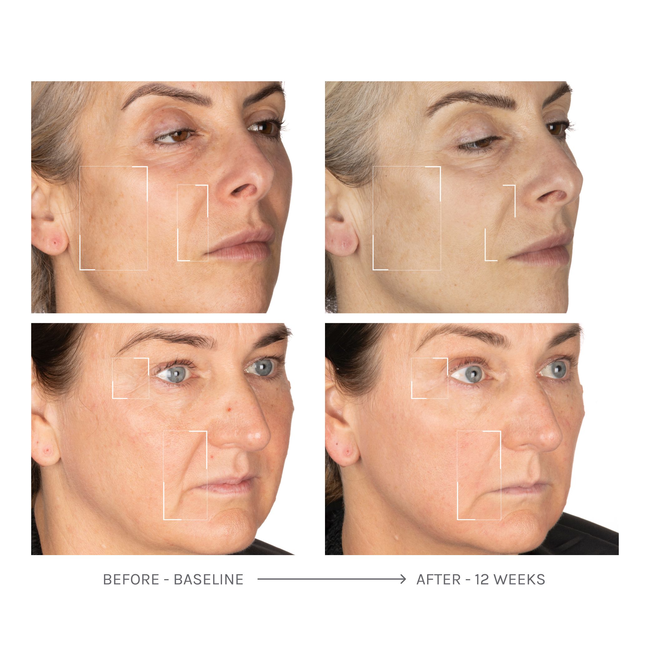Visible results on woman's face from OHUI Reverse Activator Cream, before and after 12 weeks of use.