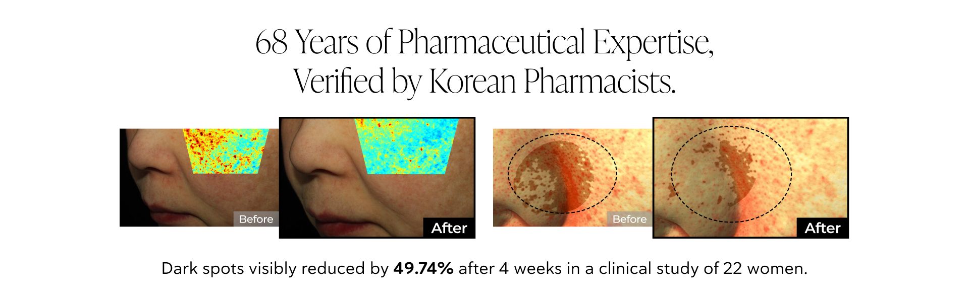 Before and after images showing improved skin with faded dark spots, a jar of brightening cream, and text "Visible Results in 2 Weeks".