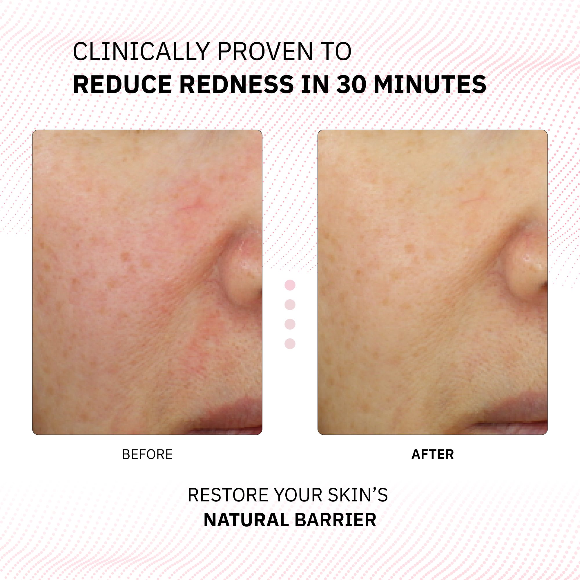 A before-and-after image of face skin looking clean and healthy after using Physiogel Calming Relief.