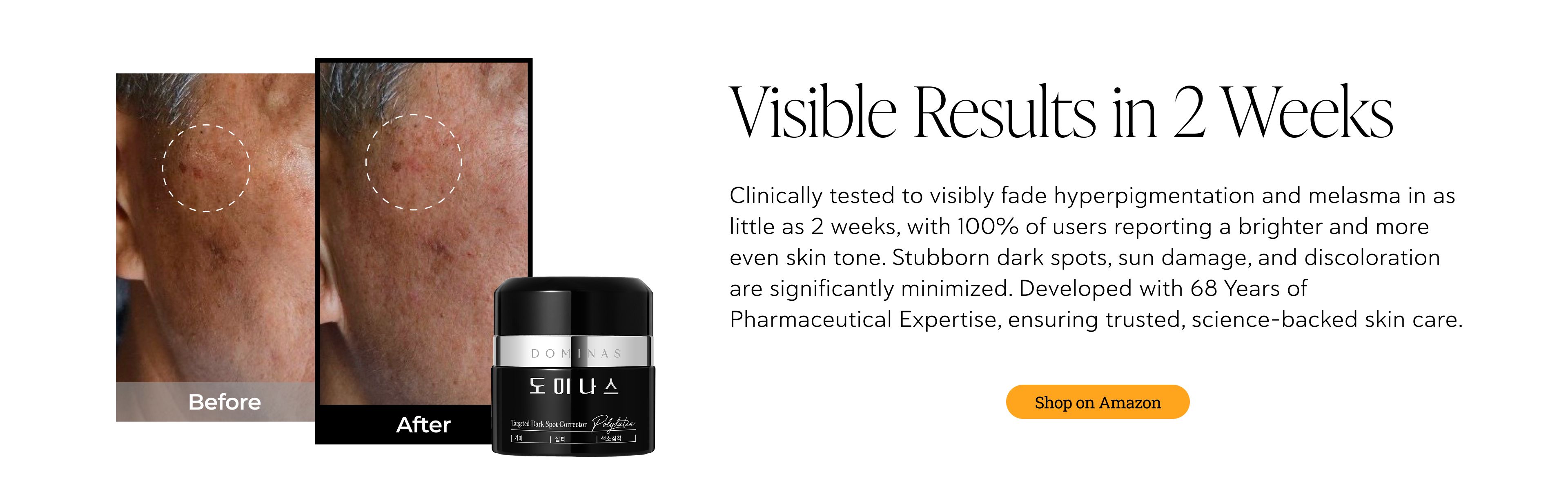 Before and after images showing improved skin with faded dark spots, a jar of brightening cream, and text "Visible Results in 2 Weeks".