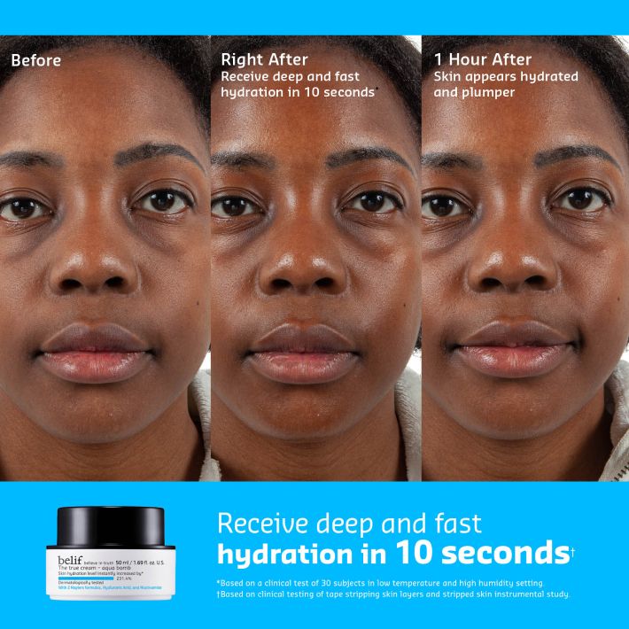 Three sequential close-up photos of a woman's face showing skin improvement: "before" with dry skin, "right after" post-application of belif Aqua Bomb Moisturizer, and "1 hour after" showing hydrated and plumper skin.