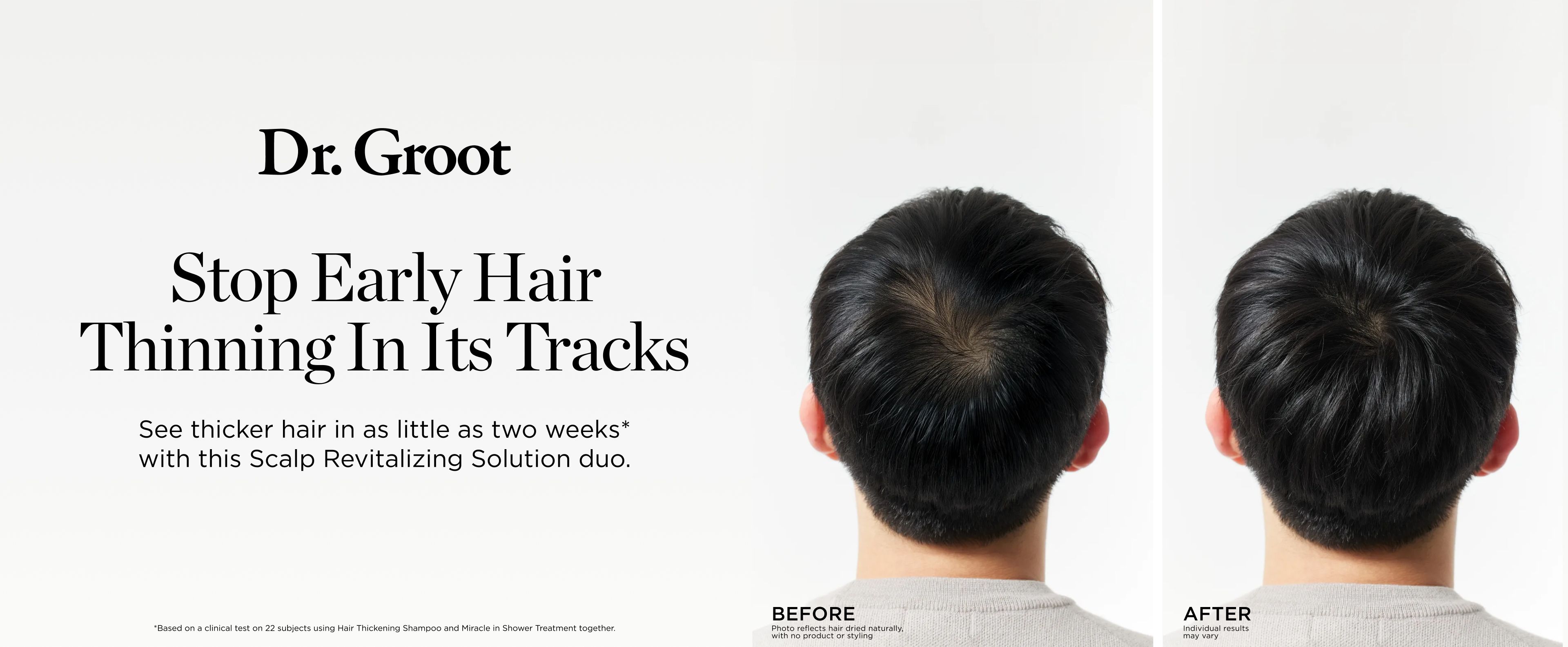 Hero split section content background image