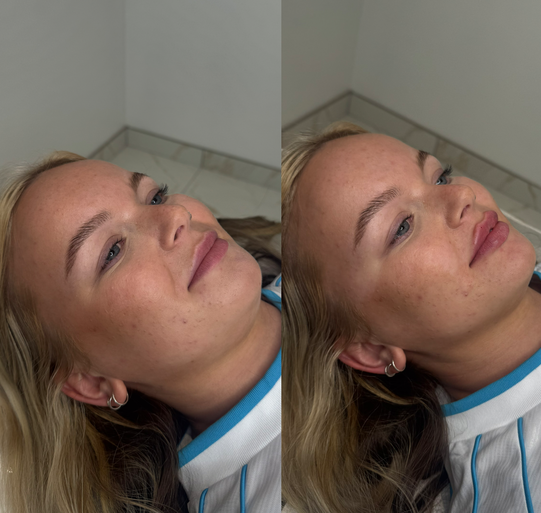 blonde before and after