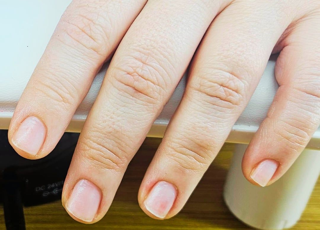 Dépose Gel-X