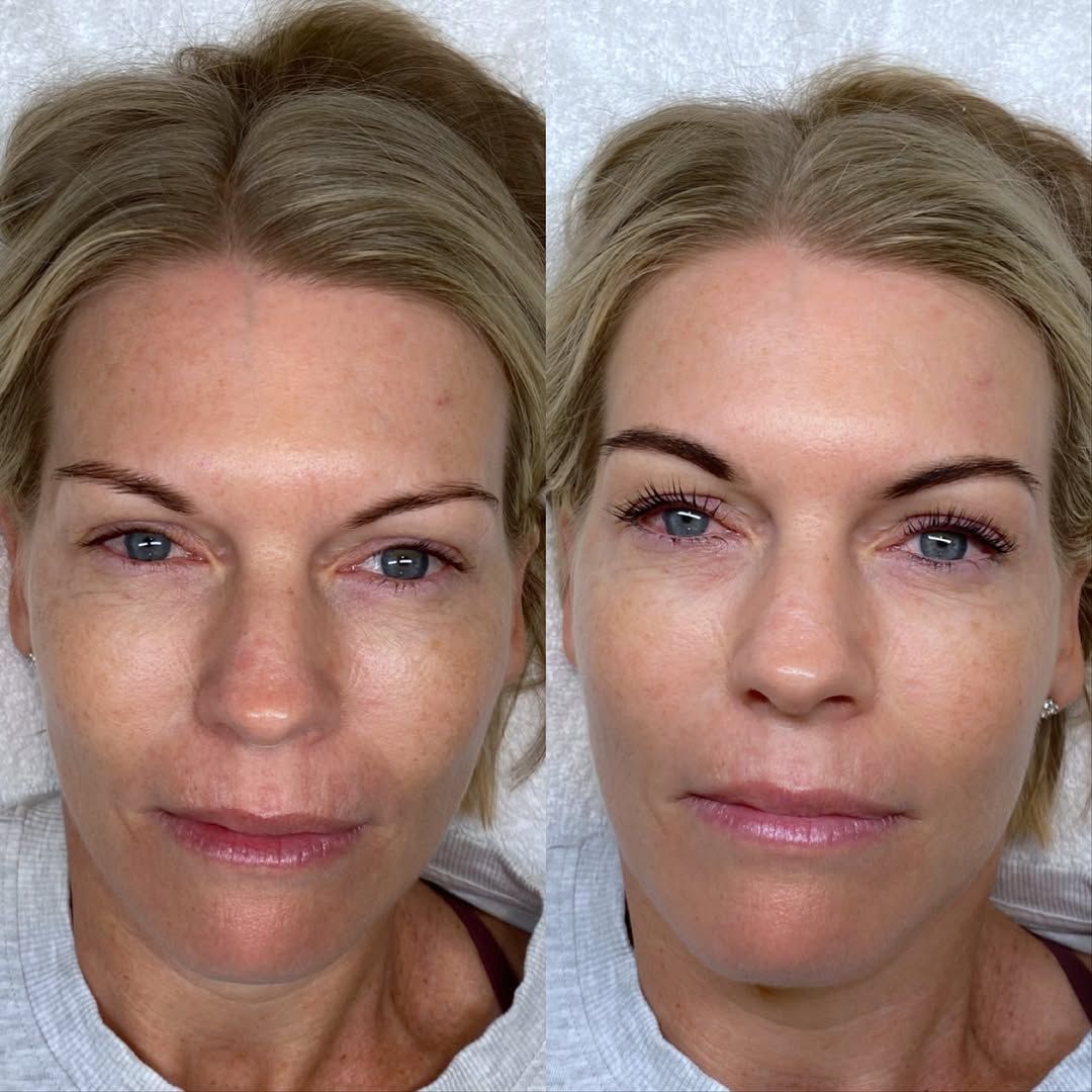 Before and after front view of an Ultimate Eye Package lash lift and brow tint result