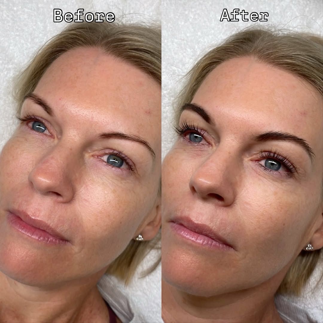 Before and after angled view of lifted lashes and shaped brows after an Ultimate Eye Package