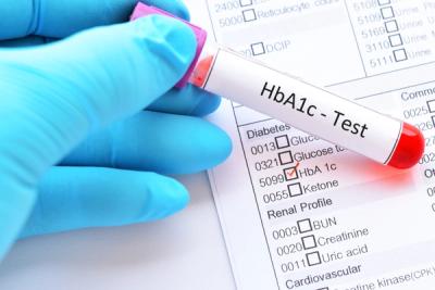 HbA1c test result with blood sample.