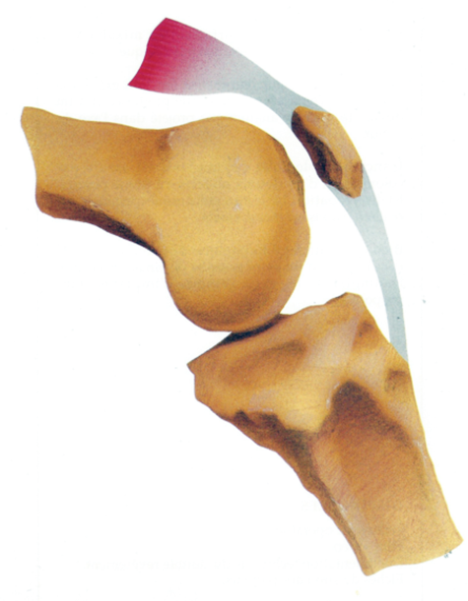 Stabilisation de la rotule — illustration 3