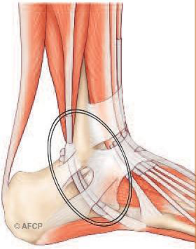 Tendons fibulaires — illustration 1