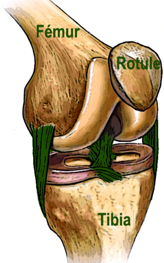 Prothèse de genou — illustration 2