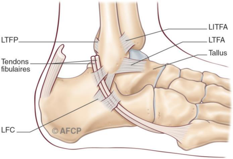 Ligamentoplastie de cheville — illustration 2
