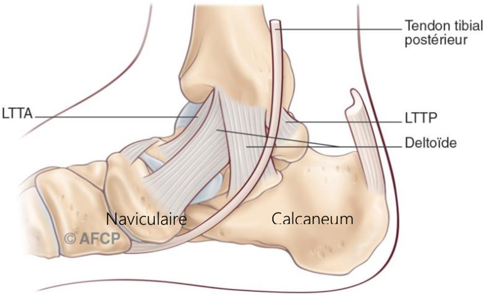Ligamentoplastie de cheville — illustration 3