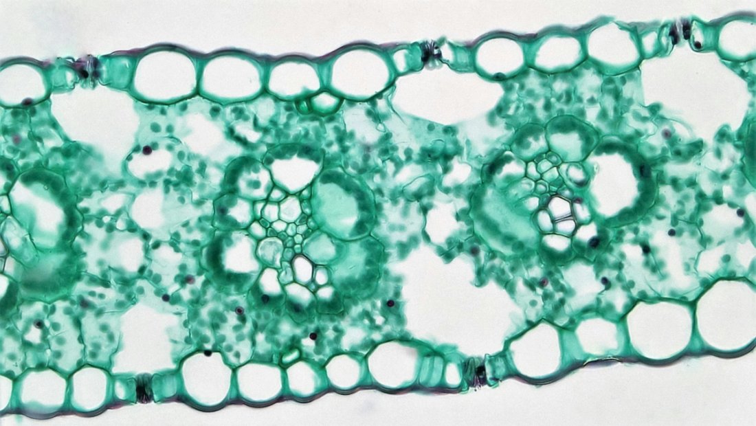 A green substance under a microscope.