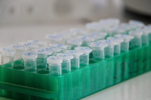 Clear plastic vials in a green tray