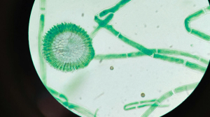 An image of a green cell under a microscope.