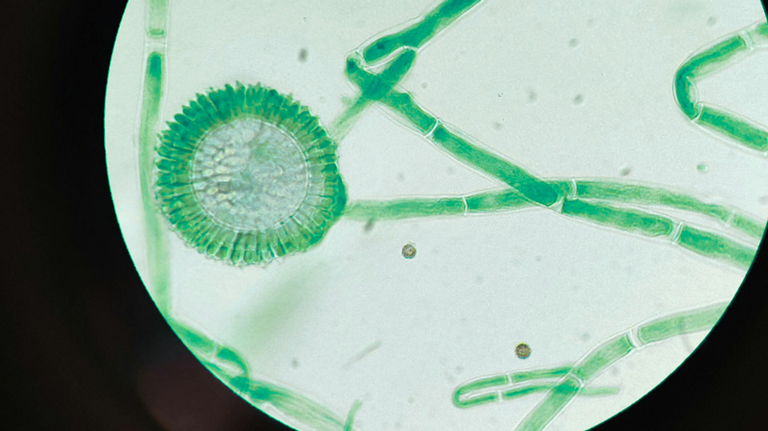 An image of a green cell under a microscope.