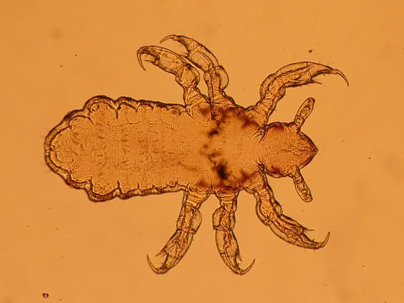 louse