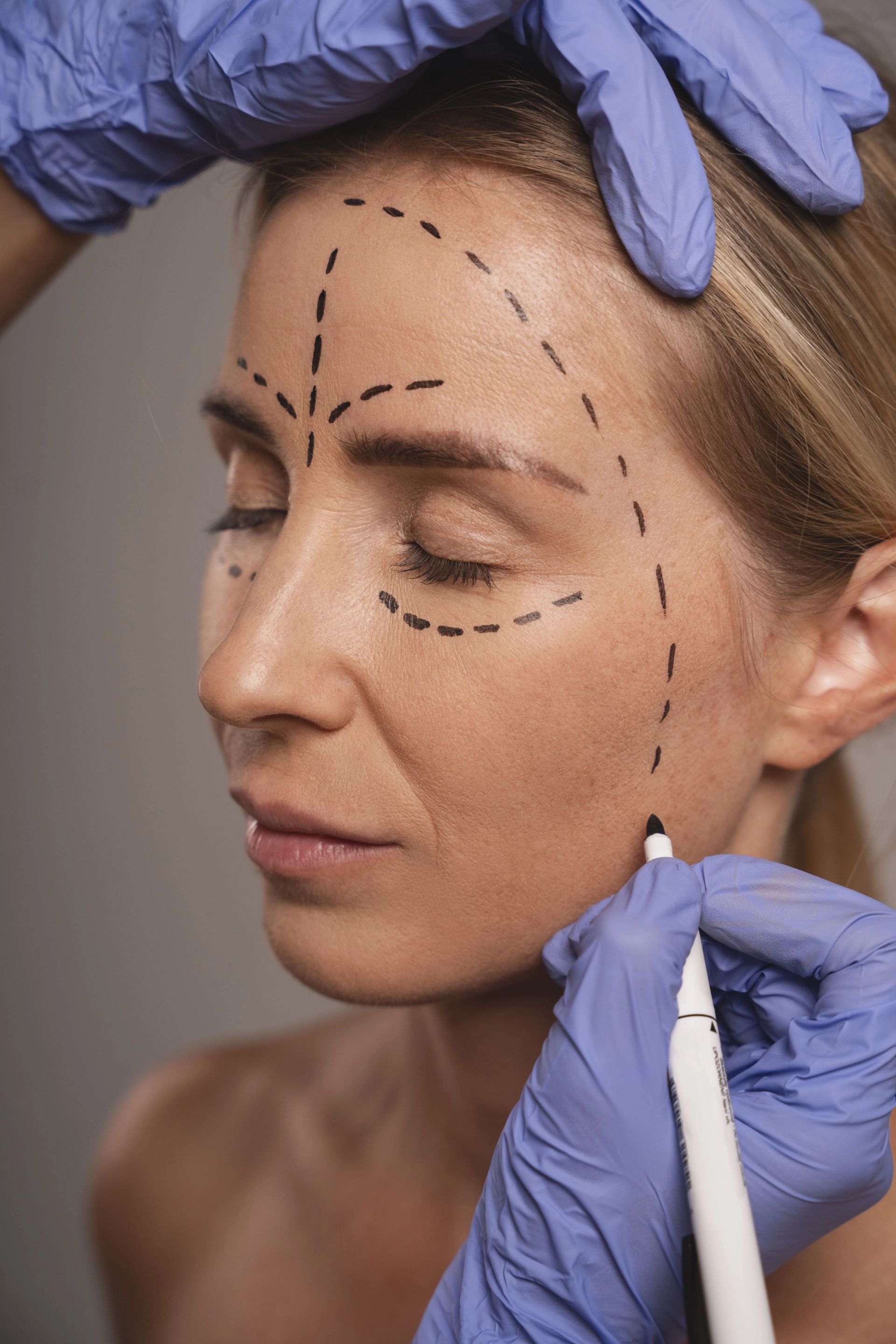 Une femme préparant une chirurgie esthétique