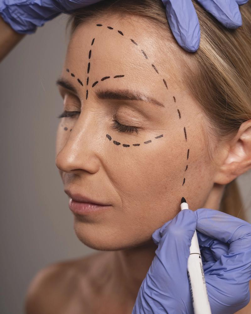 Frau bereitet Schönheitsoperation vor