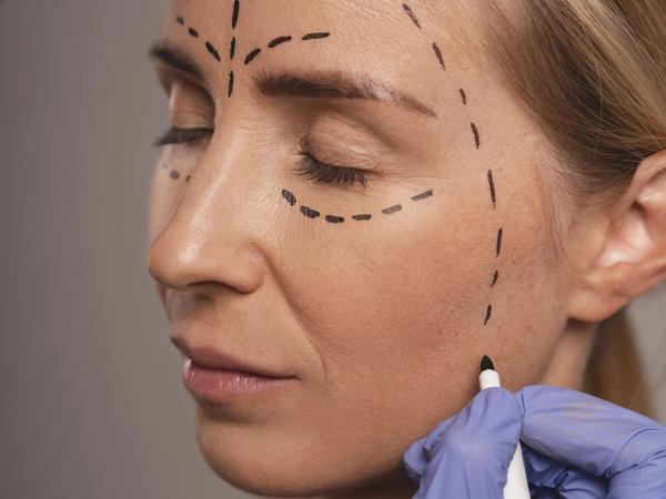 Une femme préparant une chirurgie esthétique