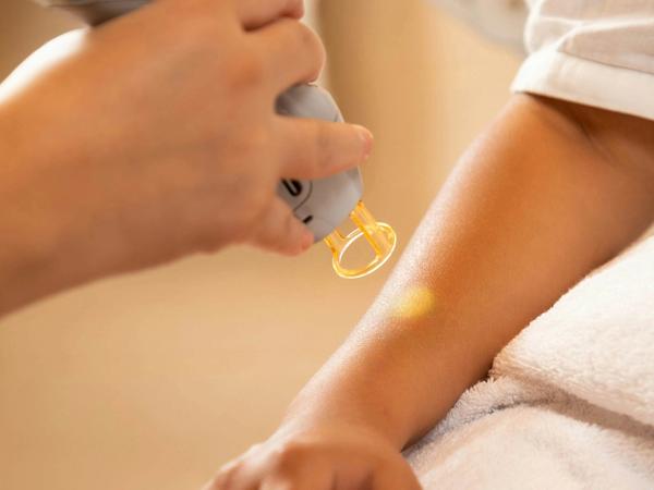 Un patient recevant un traitement dermatologique