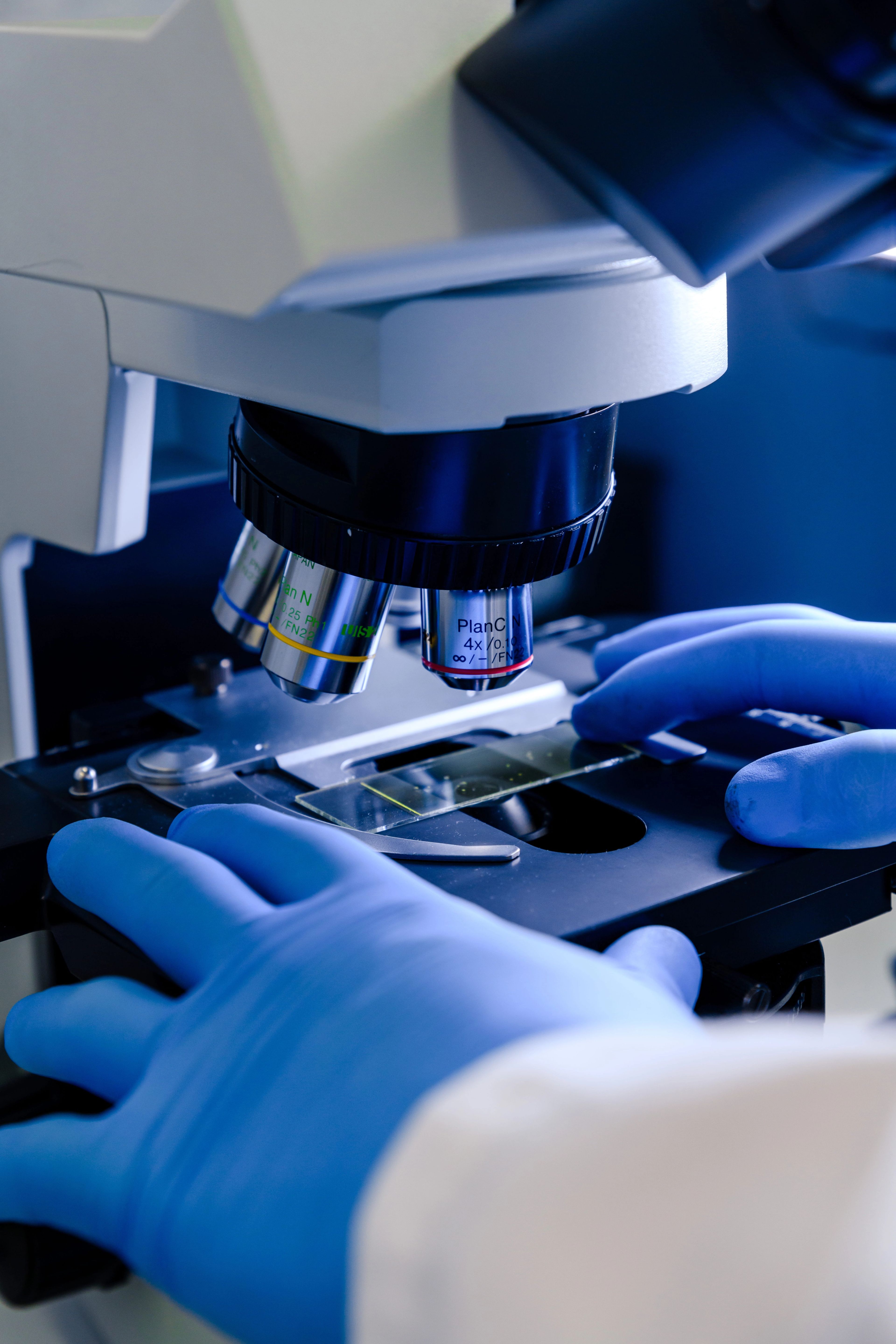 Tecnico di laboratorio analizza campioni di biopsia utilizzando un microscopio moderno