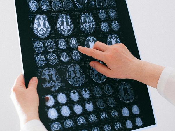 Médecin vérifiant la radiographie