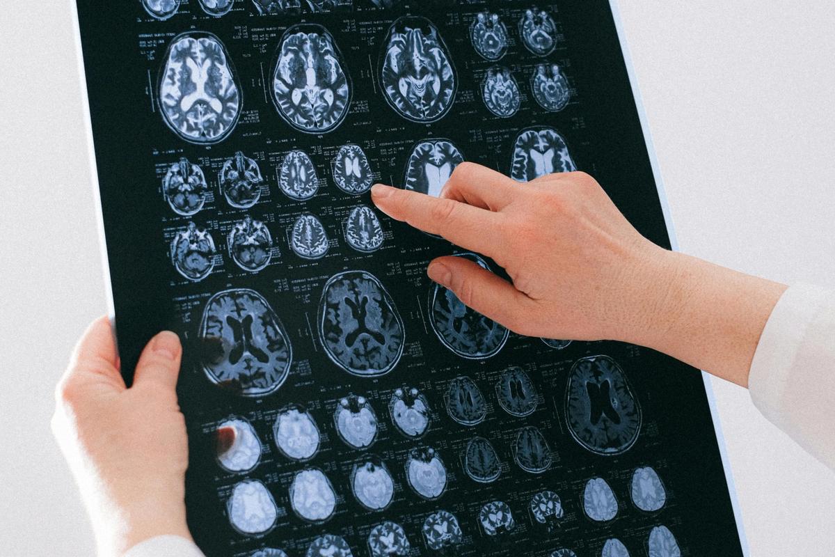 Médecin vérifiant la radiographie