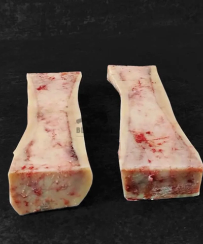 Bone Marrow