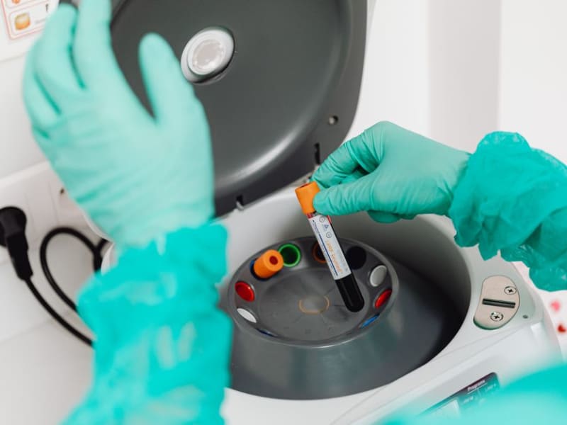 How to Test Radiation Protection Gloves: A Complete Guide