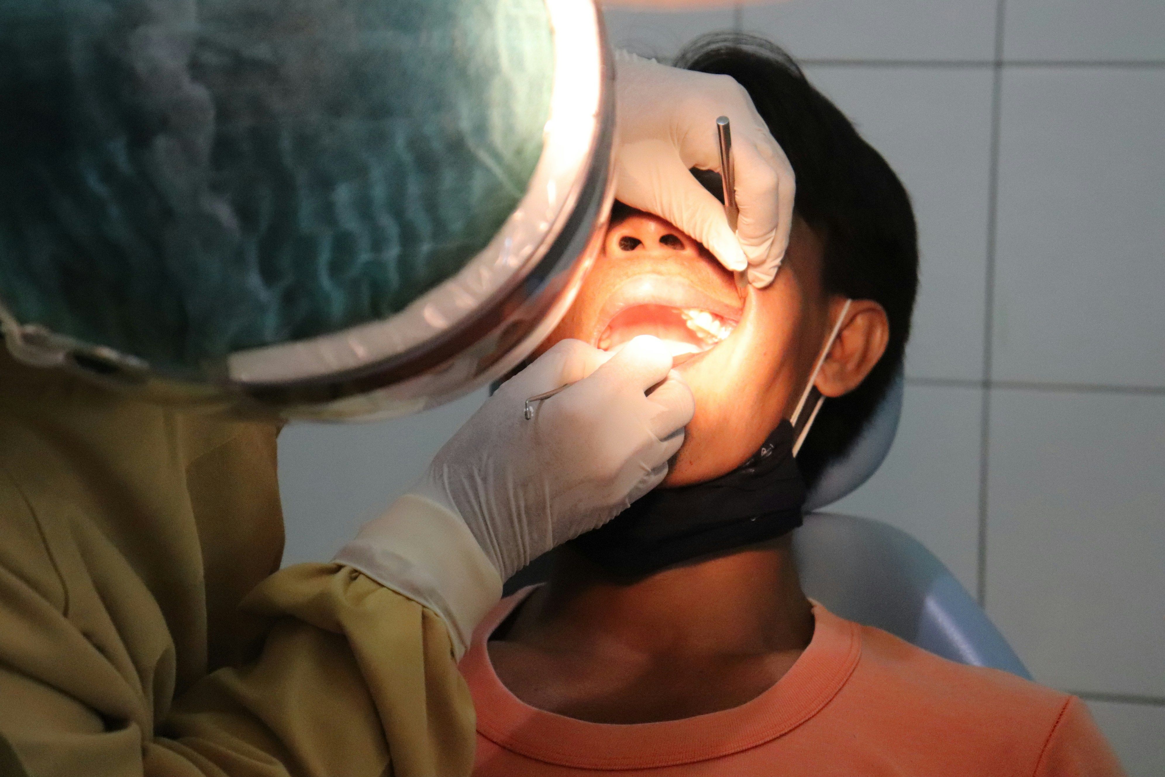 Gingivitt – den tidlige tannkjøttsbetennelsen som kan gå over