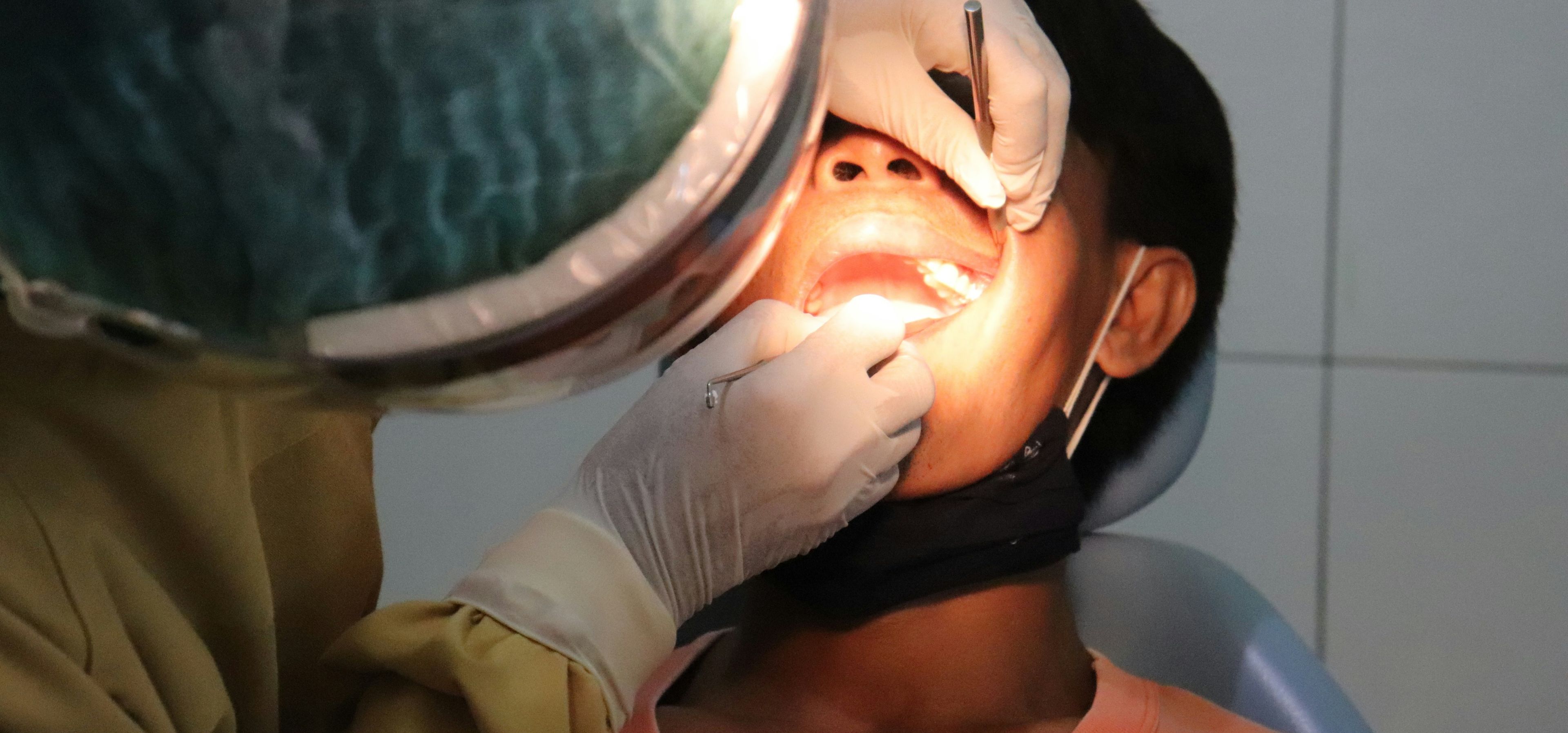 Gingivitt – den tidlige tannkjøttsbetennelsen som kan gå over