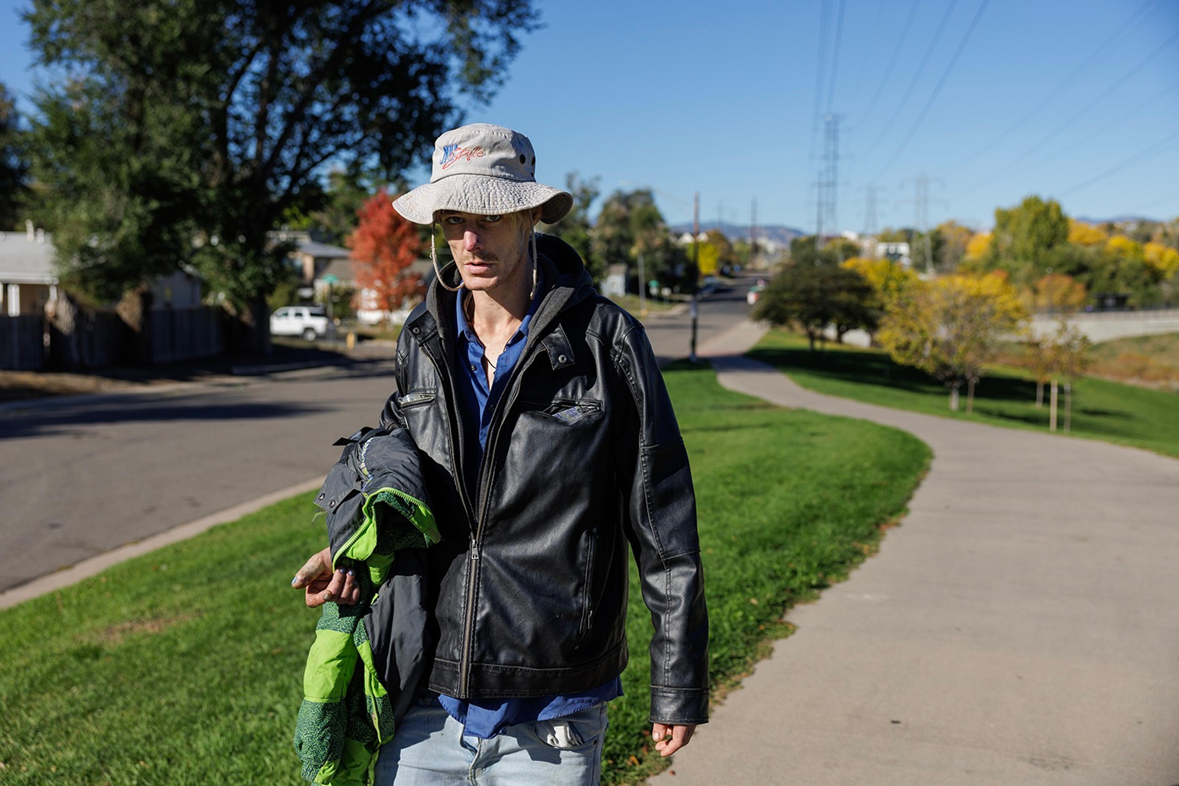 Teaya Wrexha, whose hand became infected while she was sleeping rough