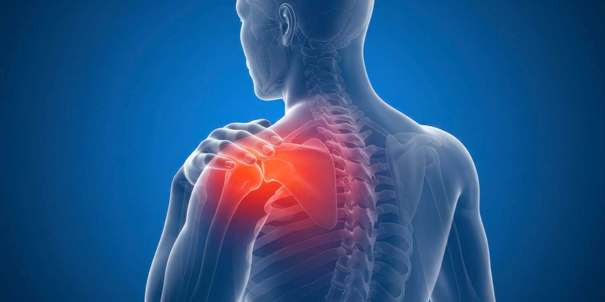 Frozen Shoulder: Why Early Movement Matters