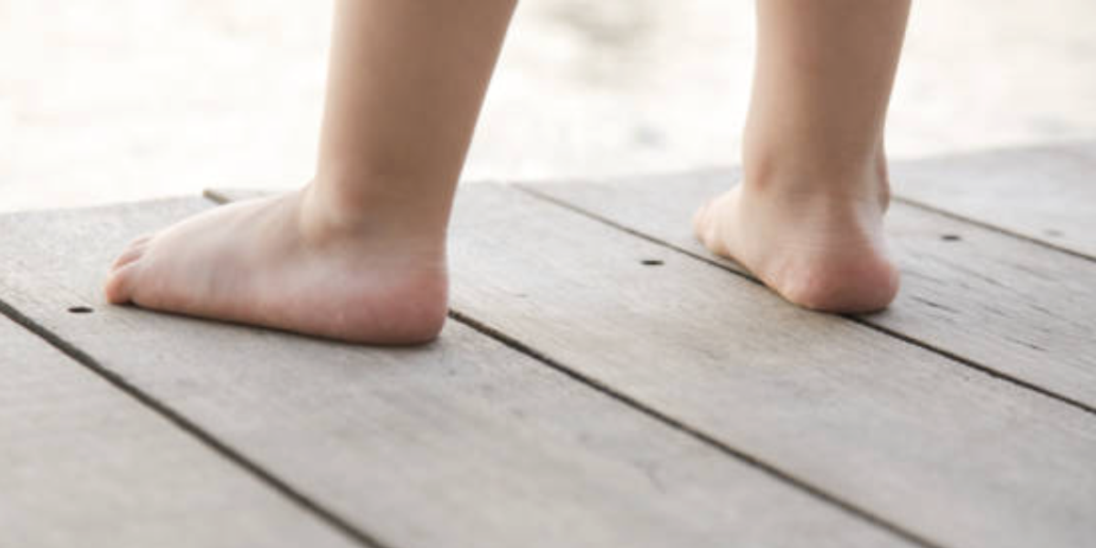 Flat Feet in Kids: When to Worry