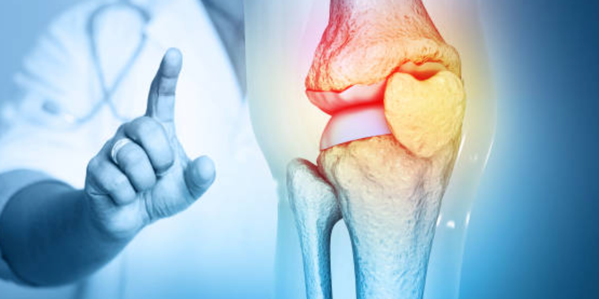 Osteoarthritis: Why Movement Is Medicine