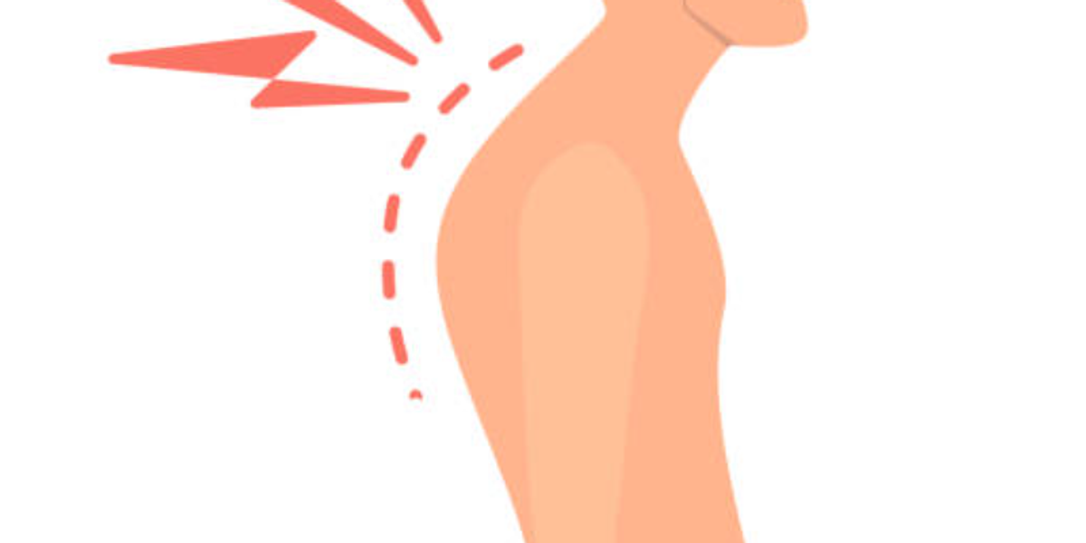 Muscle Imbalances: The Hidden Cause of Recurrent Injuries