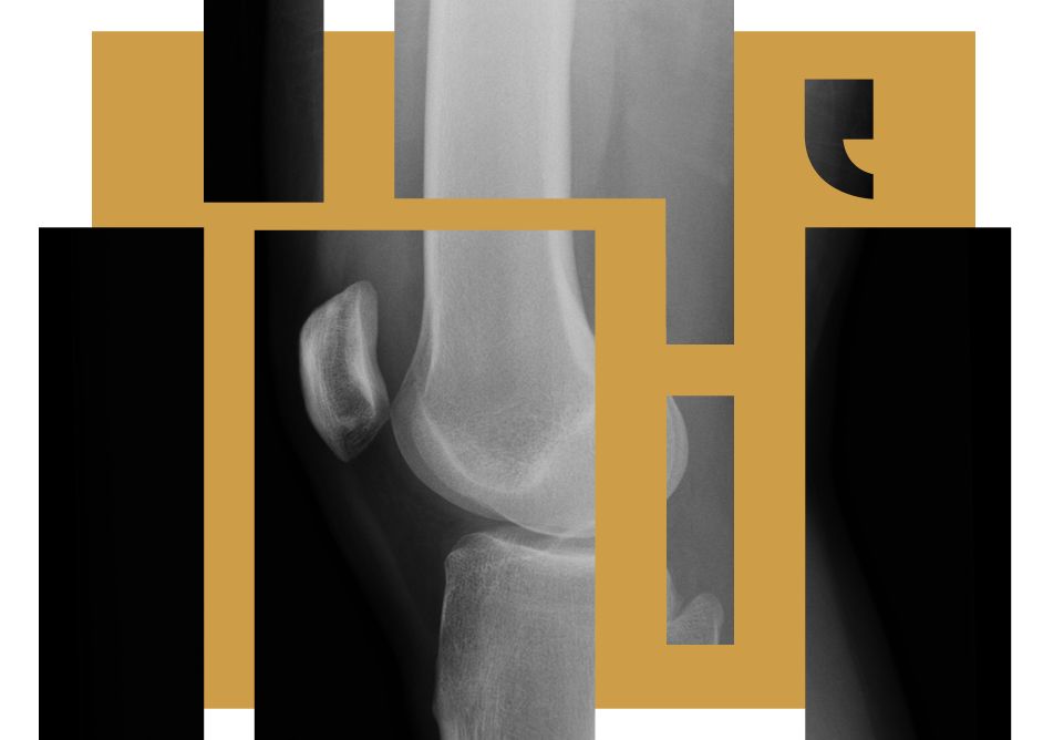 Brudd er tema for årets Kapittel. Profil: Solv ved Maren Dreggevik