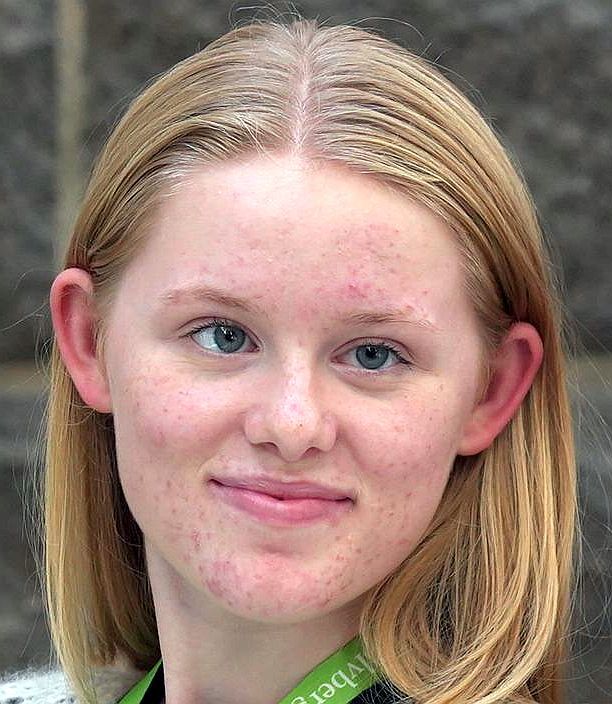 Linn Steinhaug Ådnøy portrett