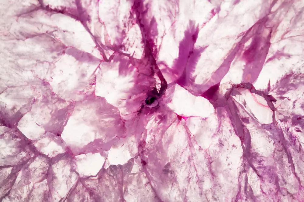 Understanding the Thymus Gland: Function, Disorders, and Treatment Options