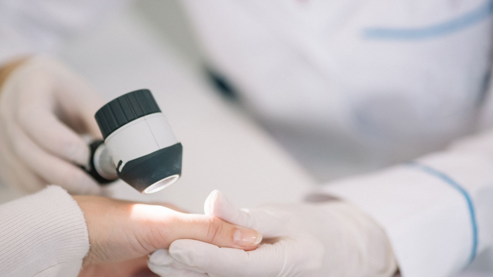 Dermatoscopie - Evaluare Alunițe și Leziuni Cutanate