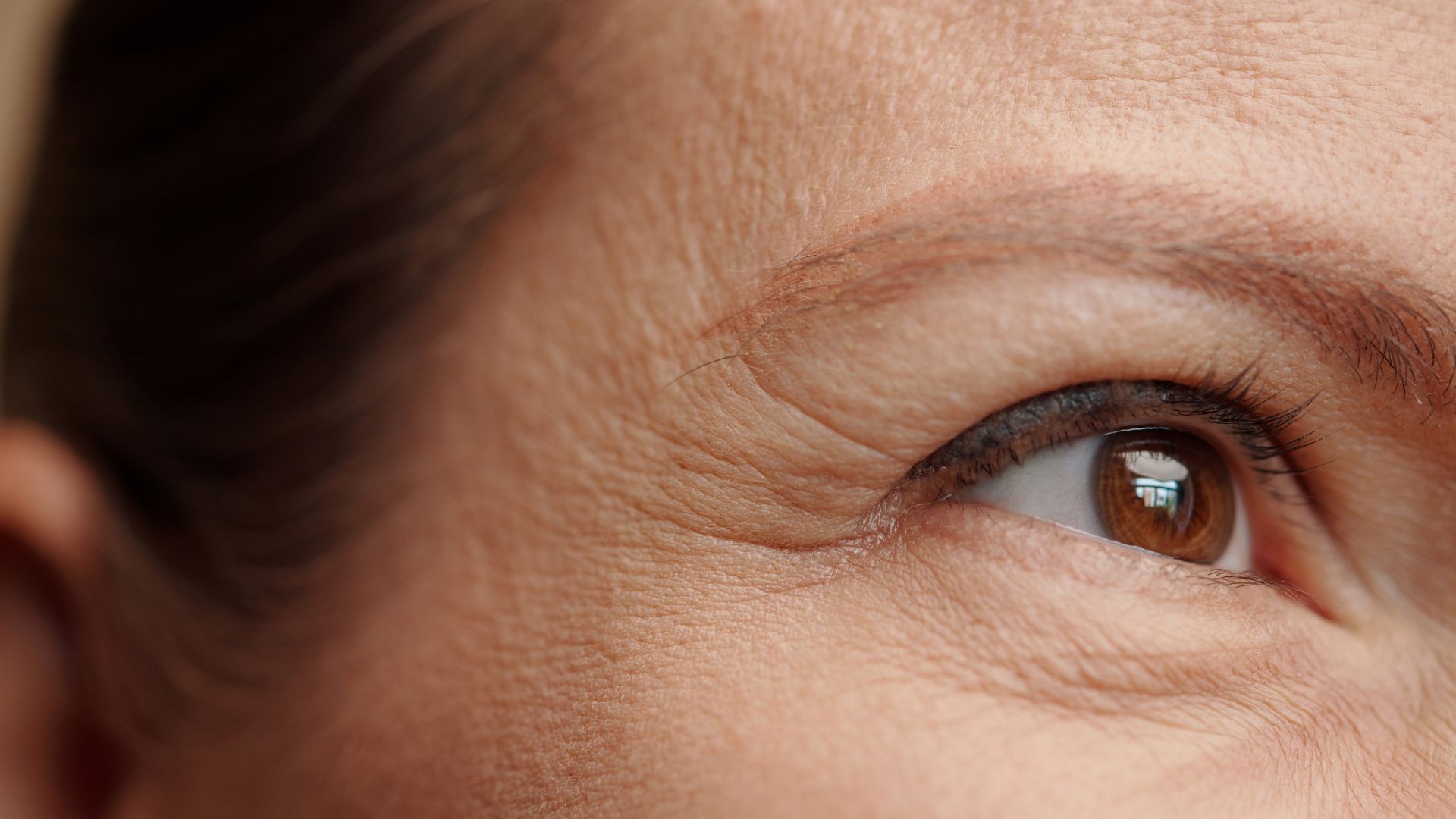 Riduri fine și textură neuniformă a pielii