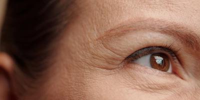 Riduri fine și textură neuniformă a pielii