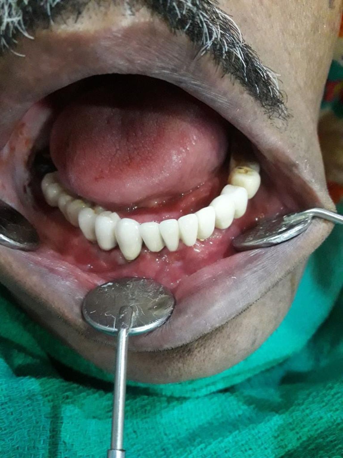 Implant image