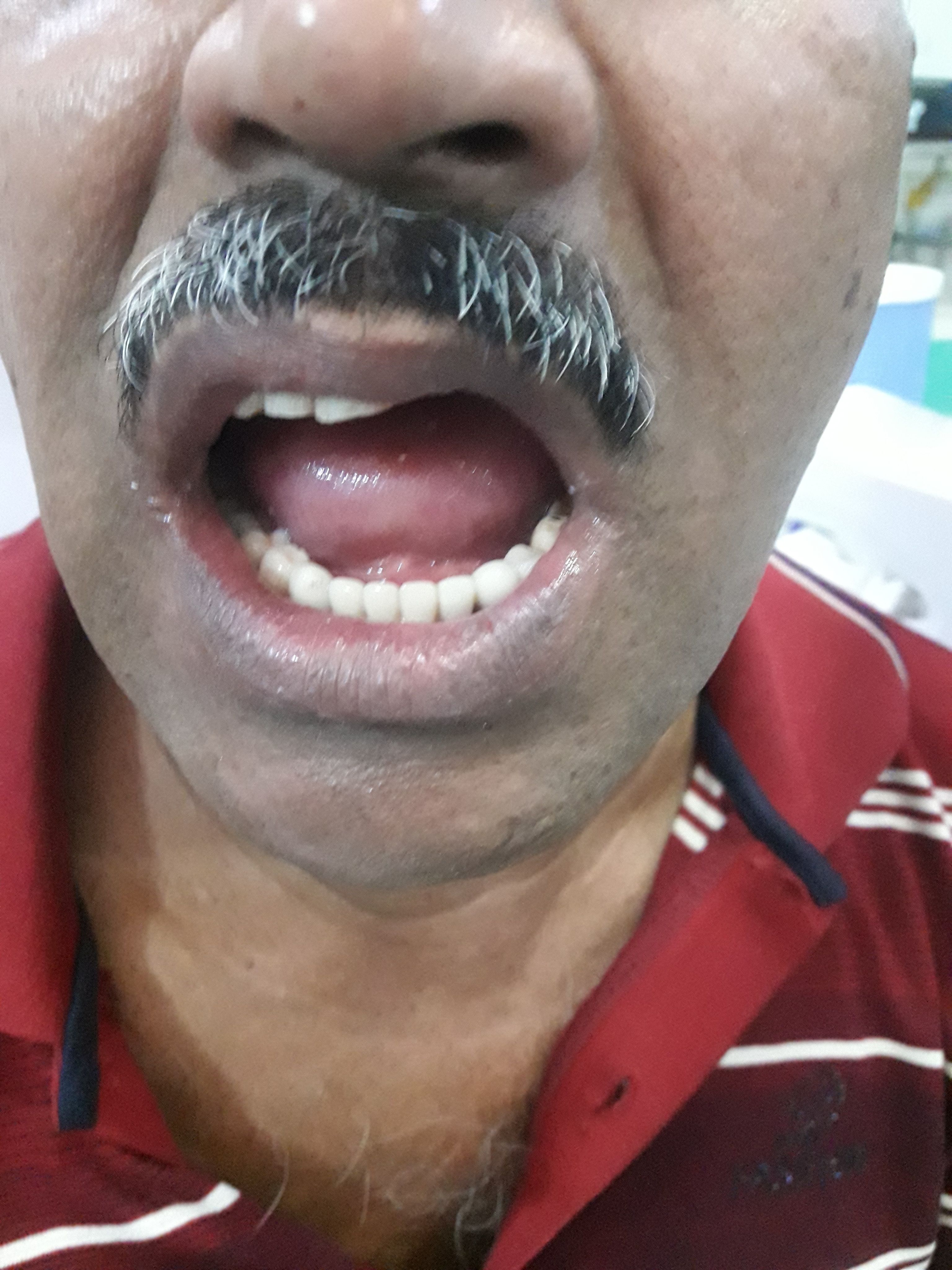 Implant image