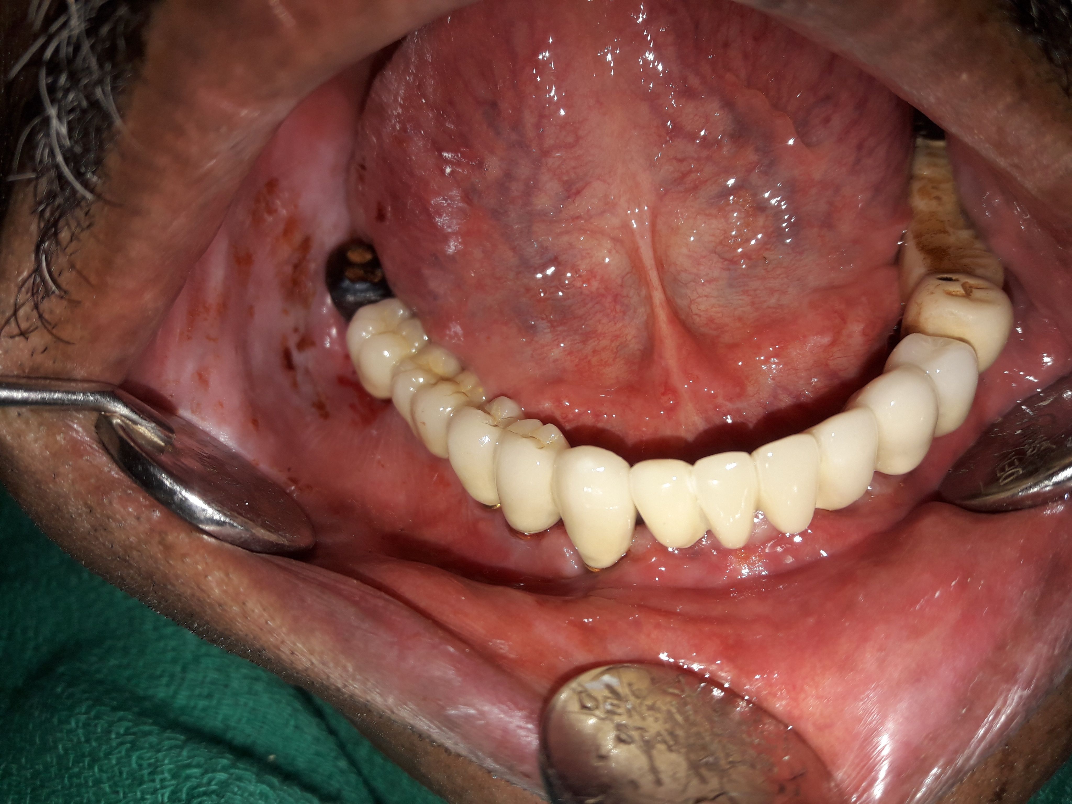 Implant image