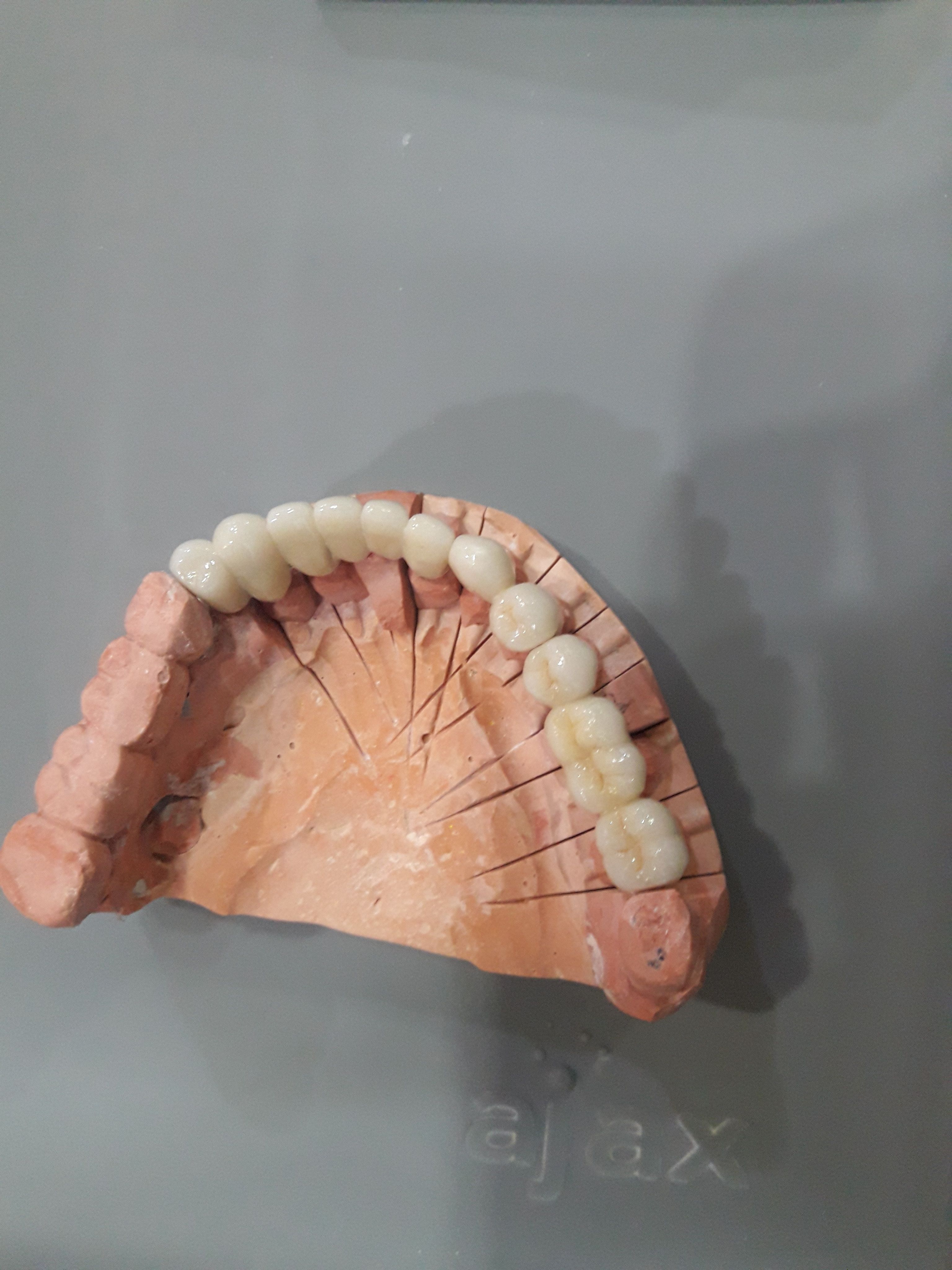 Implant image