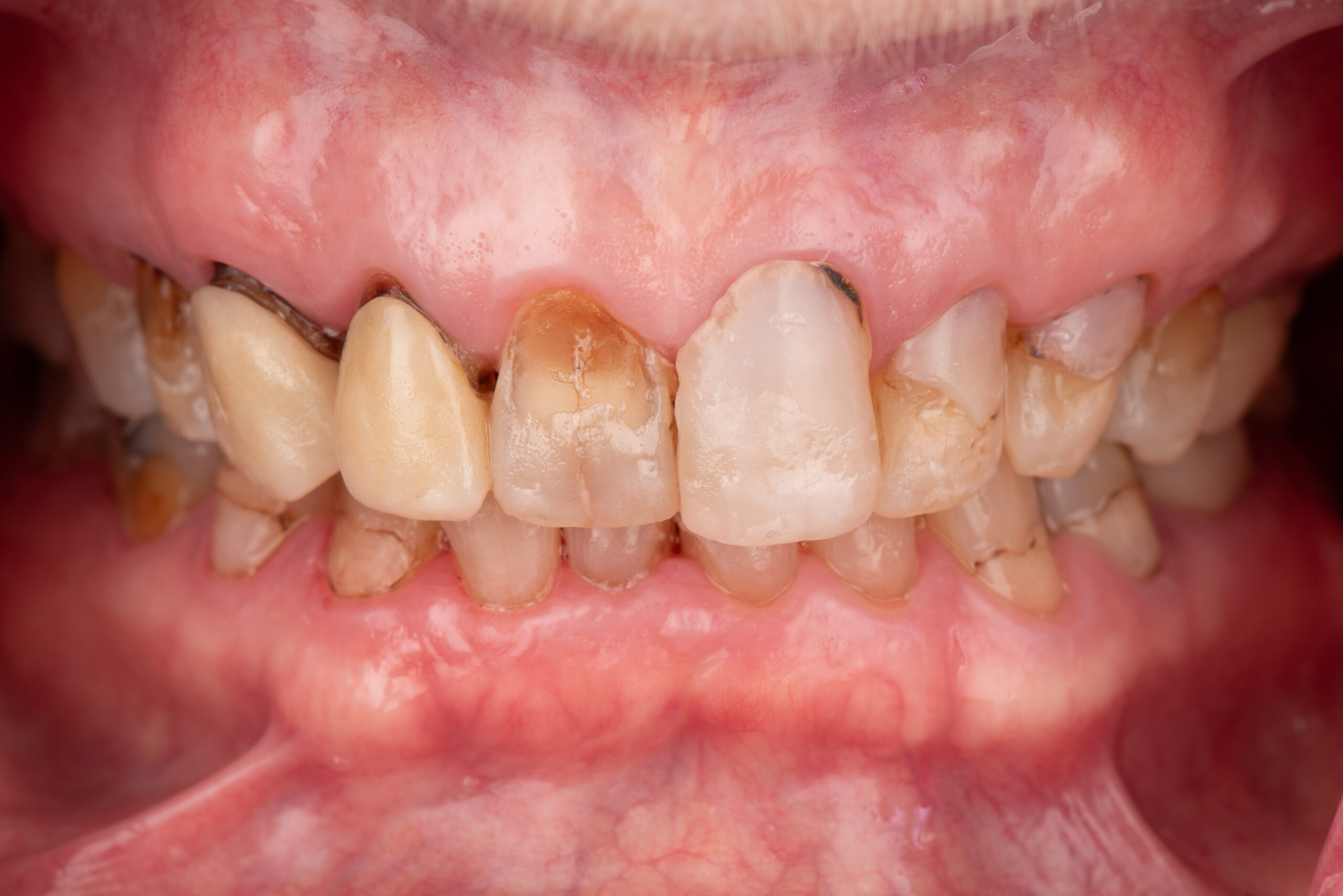 Before treatment