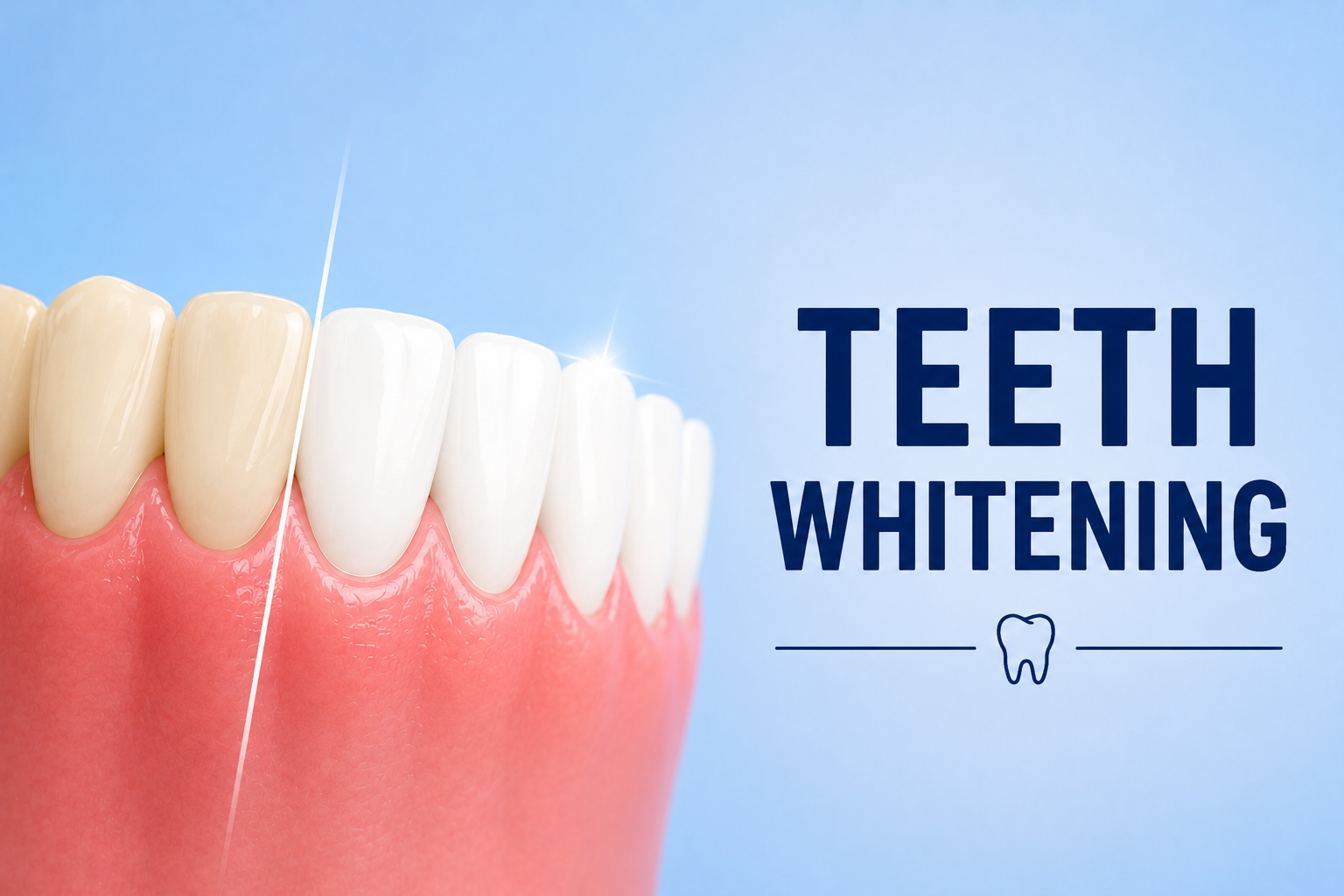 Teeth Whitening