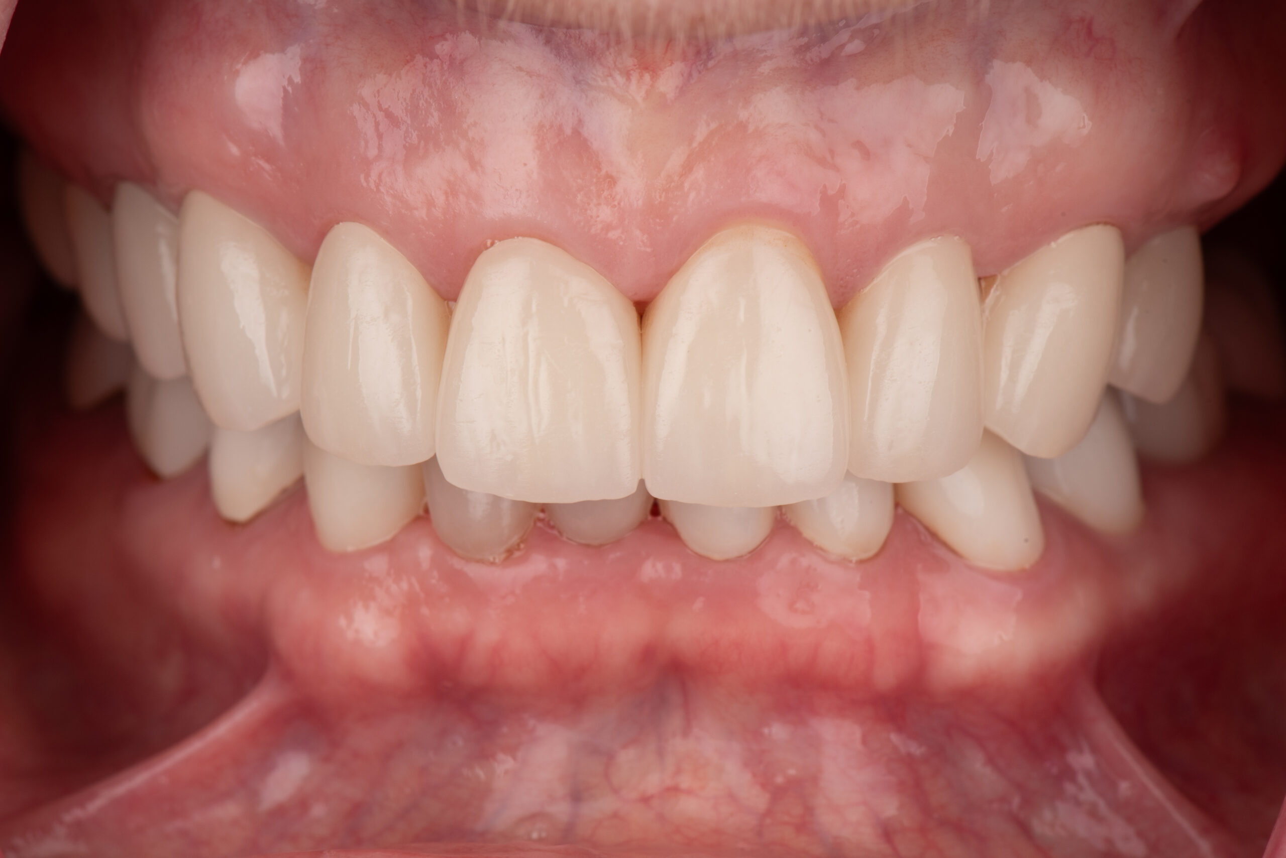 Dental.com and Firstgrin Partner to Support Parents and Babies with 24/7